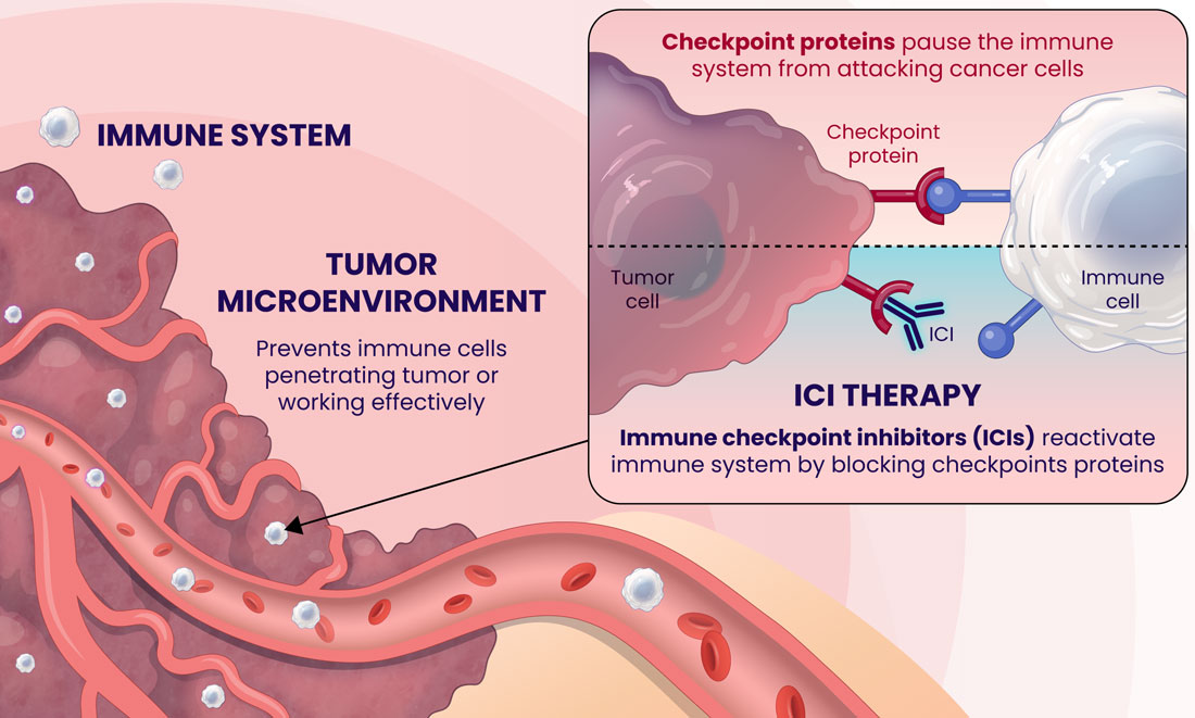 Checkpoint proteins pause the immune system from attacking cancer cells