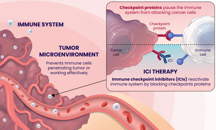 Checkpoint proteins pause the immune system from attacking cancer cells