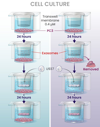 A two-row diagram illustrating an experiment on how prostate cancer cells influence immune cells without direct contact. The first row shows prostate cancer cells placed into a special chamber with a membrane barrier before immune cells are added. The second row repeats the process but removes the cancer cells before adding immune cells. In both cases, the immune cells take on a prostate cancer-specific chromosomal structure, proving that molecular signals—likely carried by exosomes—persist and transfer information even after the cancer cells are removed.