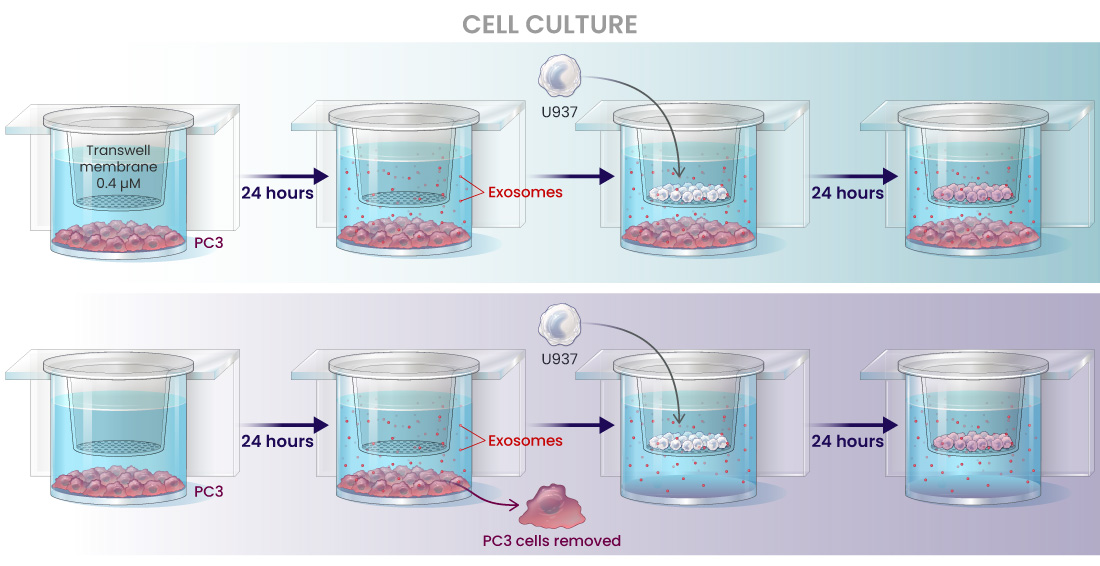 A two-row diagram illustrating an experiment on how prostate cancer cells influence immune cells without direct contact. The first row shows prostate cancer cells placed into a special chamber with a membrane barrier before immune cells are added. The second row repeats the process but removes the cancer cells before adding immune cells. In both cases, the immune cells take on a prostate cancer-specific chromosomal structure, proving that molecular signals—likely carried by exosomes—persist and transfer information even after the cancer cells are removed.